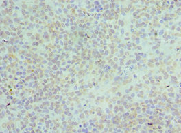 HNRNPD / AUF1 Antibody - Immunohistochemistry of paraffin-embedded human tonsil tissue using HNRNPD Antibody at dilution of 1:100