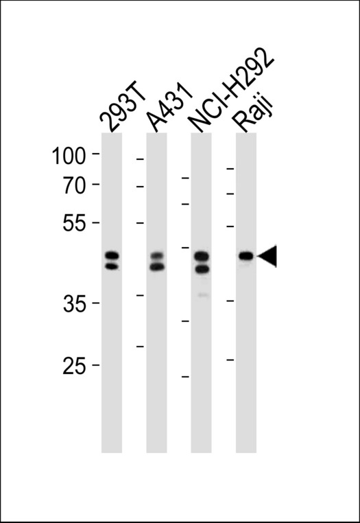 HNRNPD / AUF1 Antibody - HNRNPD Antibody western blot of 293T,A431,NCI-H292,Raji cell line lysates (35 ug/lane). The HNRNPD antibody detected the HNRNPD protein (arrow).