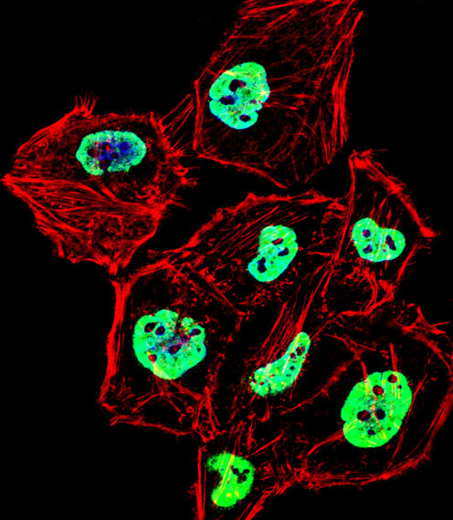 HNRNPD / AUF1 Antibody - Fluorescent confocal image of HeLa cell stained with HNRNPD Antibody. HeLa cells were fixed with 4% PFA (20 min), permeabilized with Triton X-100 (0.1%, 10 min), then incubated with HNRNPD primary antibody (1:25, 1 h at 37°C). For secondary antibody, Alexa Fluor 488 conjugated donkey anti-rabbit antibody (green) was used (1:400, 50 min at 37°C). Cytoplasmic actin was counterstained with Alexa Fluor 555 (red) conjugated Phalloidin (7units/ml, 1 h at 37°C). Nuclei were counterstained with DAPI (blue) (10 ug/ml, 10 min). HNRNPD immunoreactivity is localized to Nucleus and Cytoplasm significantly.