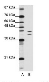HNRNPD / AUF1 Antibody - A: Marker, B: Jurkat Cell Lysate.  This image was taken for the unconjugated form of this product. Other forms have not been tested.