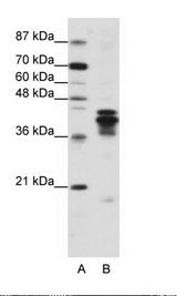 HNRNPD / AUF1 Antibody - A: Marker, B: Jurkat Cell Lysate.  This image was taken for the unconjugated form of this product. Other forms have not been tested.