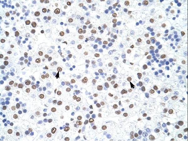 HNRNPD / AUF1 Antibody - HNRNPD / AUF1 antibody ARP40238_T100-NP_112738-HNRPD Antibody was used in IHC to stain formalin-fixed, paraffin-embedded human liver.  This image was taken for the unconjugated form of this product. Other forms have not been tested.
