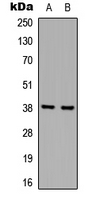 HNRNPD / AUF1 Antibody - Western blot analysis of hnRNP D0 expression in A431 (A); Jurkat (B) whole cell lysates.