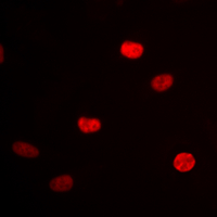 HNRNPD / AUF1 Antibody - Immunofluorescent analysis of hnRNP D0 staining in HEK293 cells. Formalin-fixed cells were permeabilized with 0.1% Triton X-100 in TBS for 5-10 minutes and blocked with 3% BSA-PBS for 30 minutes at room temperature. Cells were probed with the primary antibody in 3% BSA-PBS and incubated overnight at 4 deg C in a humidified chamber. Cells were washed with PBST and incubated with a DyLight 594-conjugated secondary antibody (red) in PBS at room temperature in the dark. DAPI was used to stain the cell nuclei (blue).