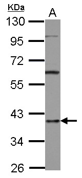 HNRNPD / AUF1 Antibody - Sample (30 ug of whole cell lysate) A: A431 10% SDS PAGE HNRNPD / AUF1 antibody diluted at 1:1000