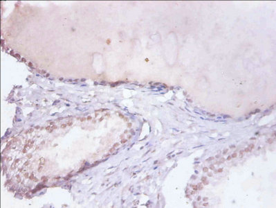HNRNPD / AUF1 Antibody - Immunohistochemistry of paraffin-embedded human prostate tissue using HNRNPD Antibody at dilution of 1:100