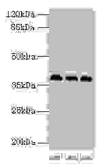HNRNPD / AUF1 Antibody - Western blot All lanes: HNRPD antibody at 2µg/ml Lane 1: 293T whole cell lysate Lane 2: Hela whole cell lysate Lane 3: Jurkat whole cell lysate Secondary Goat polyclonal to rabbit IgG at 1/10000 dilution Predicted band size: 39, 37, 33, 31 kDa Observed band size: 39 kDa