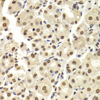 HNRNPD / AUF1 Antibody - Immunohistochemistry of paraffin-embedded Human gastric tissue.