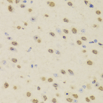 HNRNPD / AUF1 Antibody - Immunohistochemistry of paraffin-embedded Mouse brain tissue.