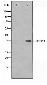 HNRNPD / AUF1 Antibody - Western blot of HUVEC cell lysate using hnRPD Antibody
