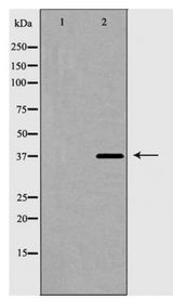 HNRNPD / AUF1 Antibody - Western blot of hnRPD expression in 293 cell extract