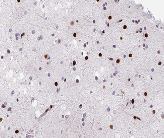 HNRNPD / AUF1 Antibody - 1:200 staining human brain tissue by IHC-P. The tissue was formaldehyde fixed and a heat mediated antigen retrieval step in citrate buffer was performed. The tissue was then blocked and incubated with the antibody for 1.5 hours at 22°C. An HRP conjugated goat anti-rabbit antibody was used as the secondary.