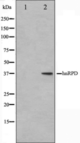 HNRNPD / AUF1 Antibody - Western blot analysis on HuvEc cell lysates using hnRPD antibody. The lane on the left is treated with the antigen-specific peptide.
