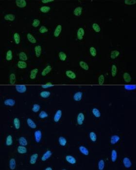 HNRNPD / AUF1 Antibody - Immunofluorescence analysis of U-2OS cells using HNRNPD Polyclonal Antibody at dilution of 1:100.Blue: DAPI for nuclear staining.