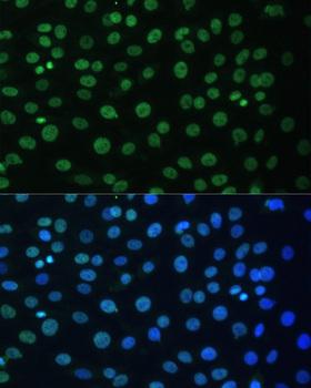 HNRNPD / AUF1 Antibody - Immunofluorescence analysis of C6 cells using HNRNPD Polyclonal Antibody at dilution of 1:100.Blue: DAPI for nuclear staining.