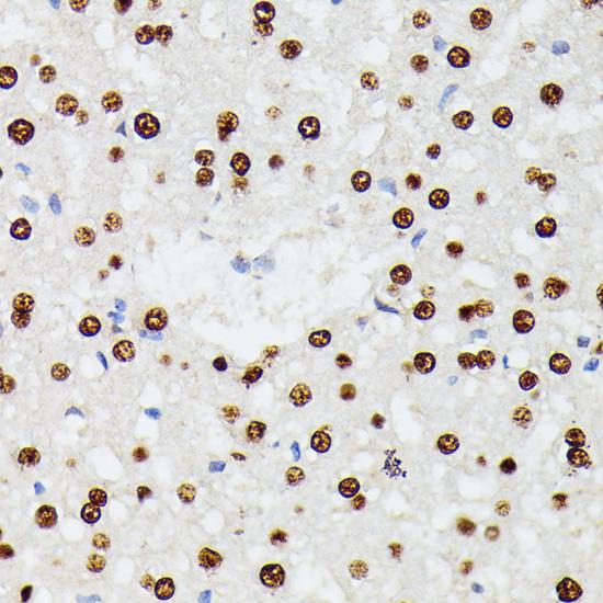 HNRNPD / AUF1 Antibody - Immunohistochemistry of paraffin-embedded Rat liver using HNRNPD Polyclonal Antibody at dilution of 1:100 (40x lens).