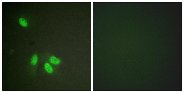 HNRNPD / AUF1 Antibody - Peptide - + Immunofluorescence analysis of HeLa cells, using hnRPD (Ab-83) antibody.