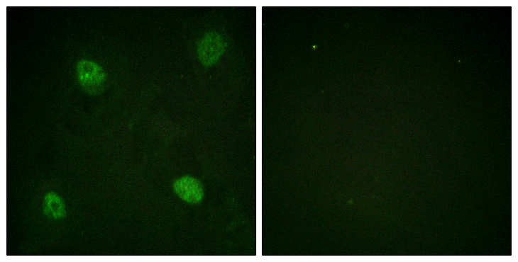 HNRNPD / AUF1 Antibody - Immunofluorescence analysis of HeLa cells, using hnRPD (Phospho-Ser83) Antibody. The picture on the right is blocked with the phospho peptide.
