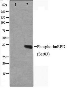 HNRNPD / AUF1 Antibody - Western blot of HUVEC cell lysate using Phospho-hnRPD(Ser83) Antibody.