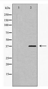 HNRNPD / AUF1 Antibody - Western blot of hnRPD (Phospho-Ser83) expression in 293 cell extract