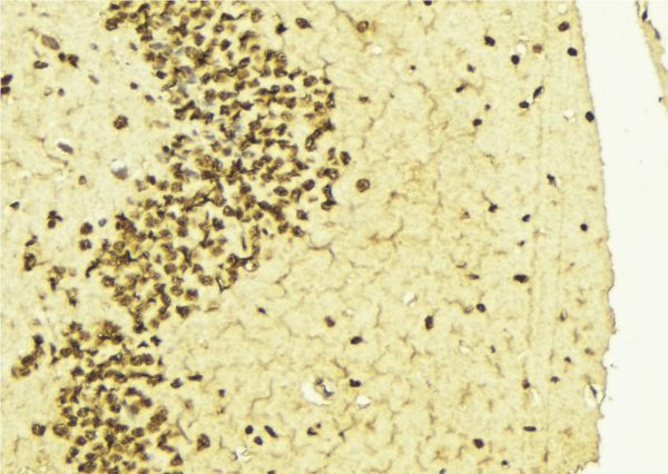 HNRNPD / AUF1 Antibody - 1:100 staining mouse brain tissue by IHC-P. The sample was formaldehyde fixed and a heat mediated antigen retrieval step in citrate buffer was performed. The sample was then blocked and incubated with the antibody for 1.5 hours at 22°C. An HRP conjugated goat anti-rabbit antibody was used as the secondary.