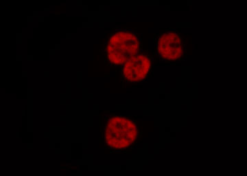 HNRNPD / AUF1 Antibody - Staining HuvEc cells by IF/ICC. The samples were fixed with PFA and permeabilized in 0.1% Triton X-100, then blocked in 10% serum for 45 min at 25°C. The primary antibody was diluted at 1:200 and incubated with the sample for 1 hour at 37°C. An Alexa Fluor 594 conjugated goat anti-rabbit IgG (H+L) Ab, diluted at 1/600, was used as the secondary antibody.