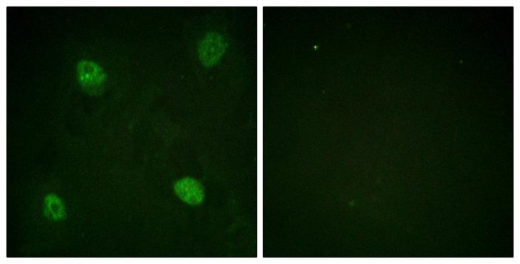 HNRNPD / AUF1 Antibody - P-peptide - + Immunofluorescence analysis of HeLa cells, using hnRPD (Phospho-Ser83) antibody.