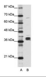 HNRNPDL / hnRNP D Antibody - A: Marker, B: Daudi Cell Lysate.  This image was taken for the unconjugated form of this product. Other forms have not been tested.