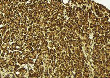 HNRNPDL / hnRNP D Antibody - 1:100 staining mouse pancreas tissue by IHC-P. The sample was formaldehyde fixed and a heat mediated antigen retrieval step in citrate buffer was performed. The sample was then blocked and incubated with the antibody for 1.5 hours at 22°C. An HRP conjugated goat anti-rabbit antibody was used as the secondary.