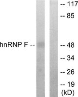 HNRNPF / hnRNP F Antibody - Western blot analysis of lysates from HepG2 cells, using hnRNP F Antibody. The lane on the right is blocked with the synthesized peptide.