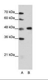 HNRNPF / hnRNP F Antibody - A: Marker, B: HepG2 Cell Lysate.  This image was taken for the unconjugated form of this product. Other forms have not been tested.
