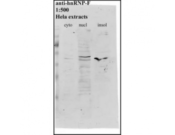 HNRNPF / hnRNP F Antibody - Western blot of HNRNPF antibody.
