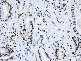 HNRNPF / hnRNP F Antibody - Immunohistochemical staining of paraffin-embedded Human prostate tissue using anti-HNRNPF mouse monoclonal antibody.