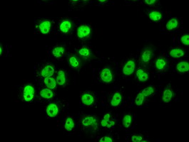 HNRNPF / hnRNP F Antibody - Anti-HNRNPF mouse monoclonal antibody  immunofluorescent staining of COS7 cells transiently transfected by pCMV6-ENTRY HNRNPF.