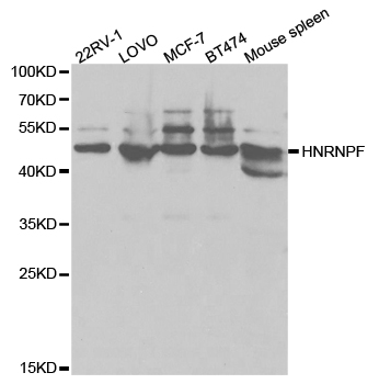 HNRNPF / hnRNP F Antibody - Western blot analysis of extracts of various cell lines.