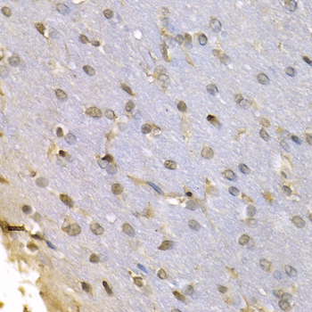 HNRNPF / hnRNP F Antibody - Immunohistochemistry of paraffin-embedded rat brain tissue.