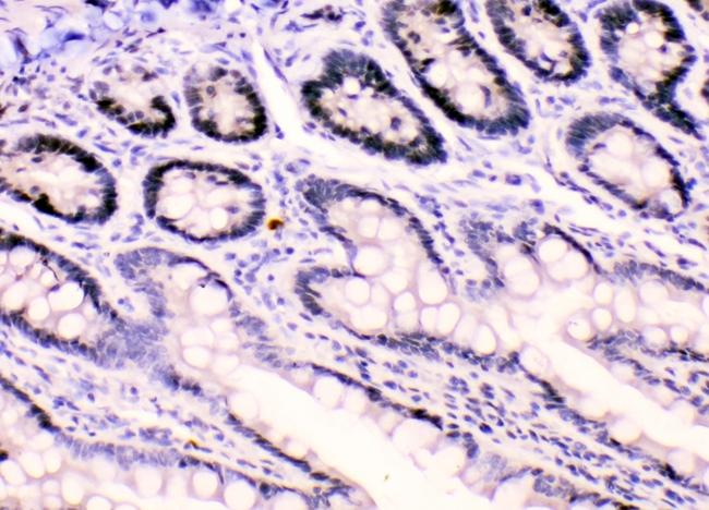 HNRNPF / hnRNP F Antibody - IHC analysis of HnRNPF using anti-HnRNPF antibody. HnRNPF was detected in paraffin-embedded section of rat intestine tissues. Heat mediated antigen retrieval was performed in citrate buffer (pH6, epitope retrieval solution) for 20 mins. The tissue section was blocked with 10% goat serum. The tissue section was then incubated with 1µg/ml rabbit anti-HnRNPF Antibody overnight at 4°C. Biotinylated goat anti-rabbit IgG was used as secondary antibody and incubated for 30 minutes at 37°C. The tissue section was developed using Strepavidin-Biotin-Complex (SABC) with DAB as the chromogen.