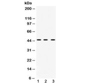 HNRNPF / hnRNP F Antibody - Western blot testing of 1) rat liver, 2) mouse spleen and 3) human HeLa cell lysate with hnRNP F antibody at 0.5ug/ml. Predicted molecular weight ~46 kDa.
