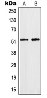 HNRNPF / hnRNP F Antibody - Western blot analysis of hnRNP F expression in HepG2 (A); Jurkat (B) whole cell lysates.