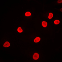 HNRNPF / hnRNP F Antibody - Immunofluorescent analysis of hnRNP F staining in Jurkat cells. Formalin-fixed cells were permeabilized with 0.1% Triton X-100 in TBS for 5-10 minutes and blocked with 3% BSA-PBS for 30 minutes at room temperature. Cells were probed with the primary antibody in 3% BSA-PBS and incubated overnight at 4 C in a humidified chamber. Cells were washed with PBST and incubated with a DyLight 594-conjugated secondary antibody (red) in PBS at room temperature in the dark. DAPI was used to stain the cell nuclei (blue).