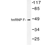 HNRNPF / hnRNP F Antibody - Western blot of hnRNP F (Y47) pAb in extracts from HepG2 cells.