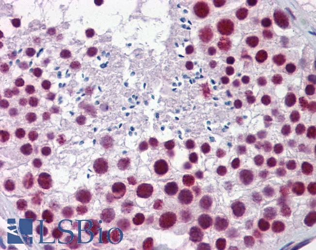 HNRNPH1 / hnRNP H Antibody - Anti-HNRNPH1 / hnRNP H antibody IHC of human testis. Immunohistochemistry of formalin-fixed, paraffin-embedded tissue after heat-induced antigen retrieval. Antibody concentration 5 ug/ml.  This image was taken for the unconjugated form of this product. Other forms have not been tested.