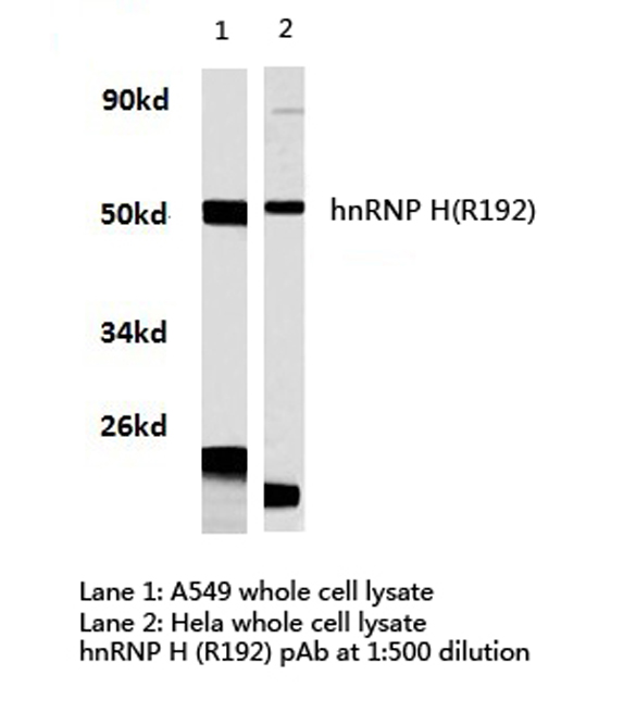 HNRNPH1 / hnRNP H Antibody - Western blot of hnRNP H (R192) pAb in extracts from HeLa and A549 cells.