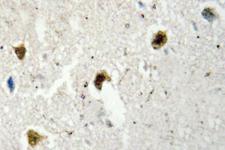 HNRNPH1 / hnRNP H Antibody - IHC of hnRNP H (R192)pAb in paraffin-embedded human brain tissue.