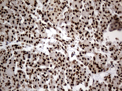 HNRNPH1 / hnRNP H Antibody - Immunohistochemical staining of paraffin-embedded Human pancreas tissue within the normal limits using anti-HNRNPH1 mouse monoclonal antibody. (Heat-induced epitope retrieval by 1mM EDTA in 10mM Tris buffer. (pH8.5) at 120°C for 3 min. (1:500)