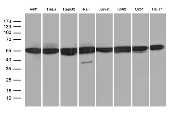 HNRNPH1 / hnRNP H Antibody - Western blot analysis of extracts. (35ug) from 8 different cell lines by using anti-HNRNPH1 monoclonal antibody. (1:500)