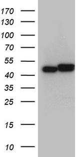 HNRNPH1 / hnRNP H Antibody - HEK293T cells were transfected with the pCMV6-ENTRY control. (Left lane) or pCMV6-ENTRY HNRNPH1. (Right lane) cDNA for 48 hrs and lysed