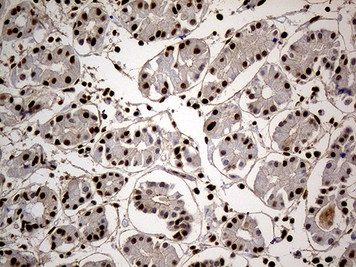 HNRNPH1 / hnRNP H Antibody - Immunohistochemical staining of paraffin-embedded Human gastric tissue within the normal limits using anti-HNRNPH1 mouse monoclonal antibody. (Heat-induced epitope retrieval by Tris-EDTA(1:500)