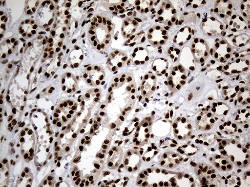 HNRNPH1 / hnRNP H Antibody - Immunohistochemical staining of paraffin-embedded Human Kidney tissue within the normal limits using anti-HNRNPH1 mouse monoclonal antibody. (Heat-induced epitope retrieval by 1mM EDTA in 10mM Tris buffer. (pH8.5) at 120°C for 3 min. (1:500)