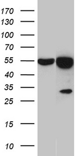 HNRNPH1 / hnRNP H Antibody - HEK293T cells were transfected with the pCMV6-ENTRY control. (Left lane) or pCMV6-ENTRY HNRNPH1. (Right lane) cDNA for 48 hrs and lysed
